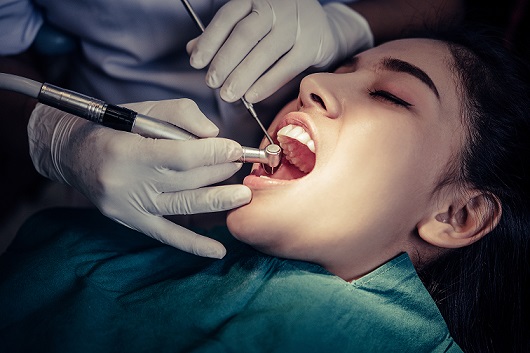 root canal treatment cost in bangalore 